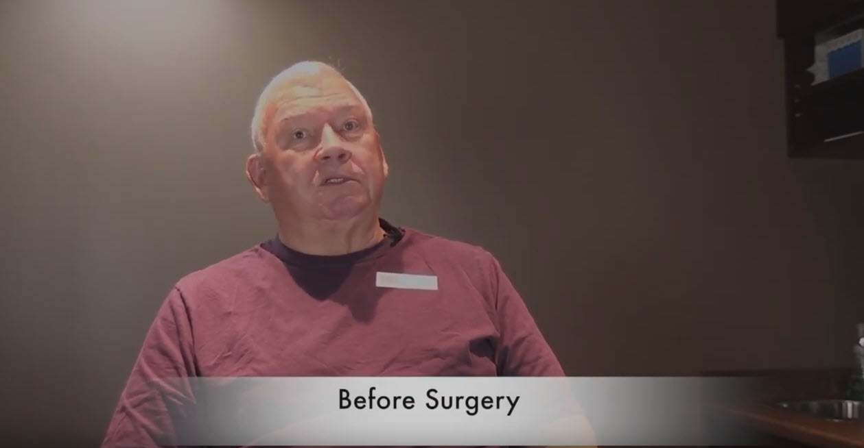 Alan Before Cataract Surgery